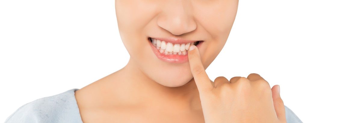 Itchy Gums: Causes and Treatment